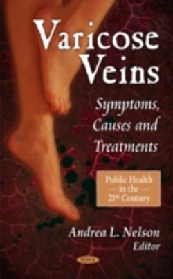 Bertrand.pt - Varicose Veins