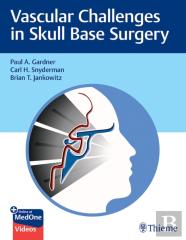 Vascular Challenges In Skull Base Surgery