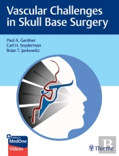 Vascular Challenges In Skull Base Surgery