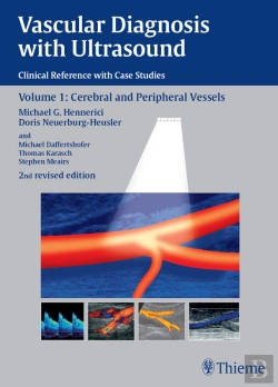 Bertrand.pt - Vascular Diagnosis With Ultrasound