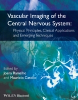Bertrand.pt - Vascular Imaging Of The Central Nervous System