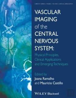 Bertrand.pt - Vascular Imaging Of The Central Nervous System