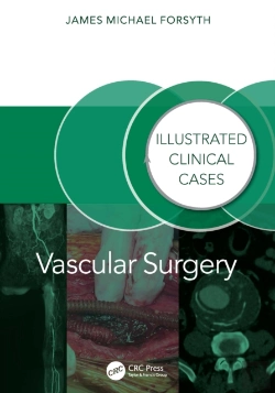 Bertrand.pt - Vascular Surgery: