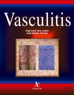 Bertrand.pt - Vasculitis