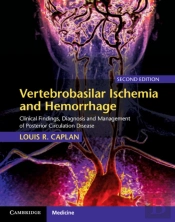 Vertebrobasilar Ischemia And Hemorrhage