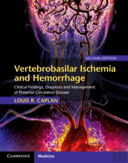 Bertrand.pt - Vertebrobasilar Ischemia And Hemorrhage
