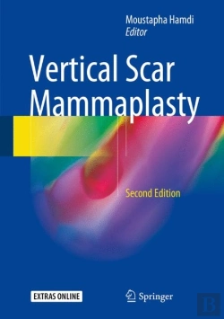Bertrand.pt - Vertical Scar Mammaplasty