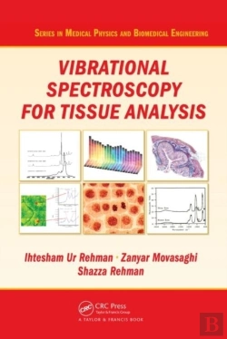 Bertrand.pt - Vibrational Spectroscopy For Tissue Analysis