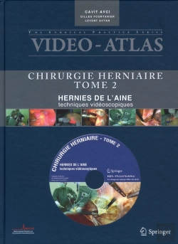 Bertrand.pt - Video Atlas Chirurgie Herniaire - T.Ii : Hernie De L'Aine, Techniques Videoscopiques