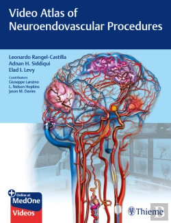Bertrand.pt - Video Atlas Of Neuroendovascular Procedures