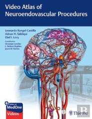 Video Atlas Of Neuroendovascular Procedures