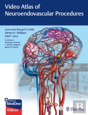 Video Atlas Of Neuroendovascular Procedures