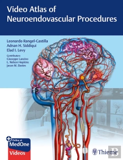 Bertrand.pt - Video Atlas Of Neuroendovascular Procedures