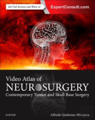 Video Atlas Of Neurosurgery