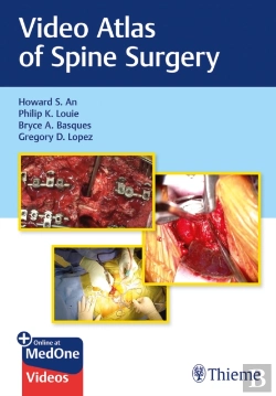 Bertrand.pt - Video Atlas Of Spine Surgery