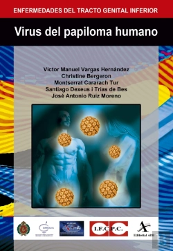 Bertrand.pt - Virus Del Papiloma Humano