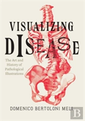 Visualizing Disease