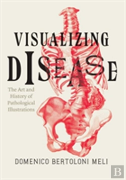 Bertrand.pt - Visualizing Disease