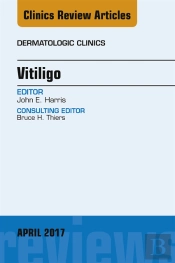 Vitiligo, An Issue Of Dermatologic Clinics
