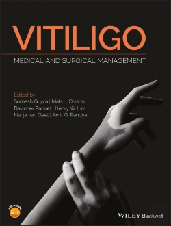 Bertrand.pt - Vitiligo