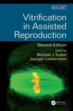 Bertrand.pt - Vitrification In Assisted Reproduction