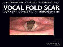 Vocal Fold Scar