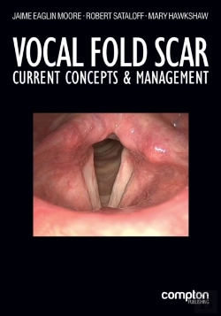 Bertrand.pt - Vocal Fold Scar