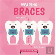 Wearing Braces