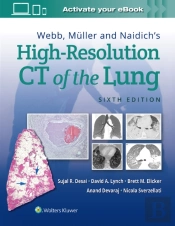 Webb, Muller And Naidich'S High-Resolution Ct Of The Lung