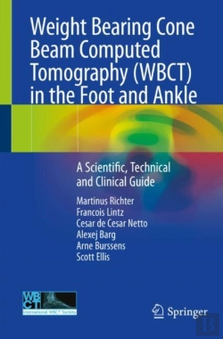 Bertrand.pt - Weight Bearing Cone Beam Computed Tomography (Wbct) In The Foot And Ankle