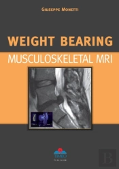 Weight Bearing Musculoskeletal Mri