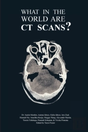 What In The World Are Ct Scans?