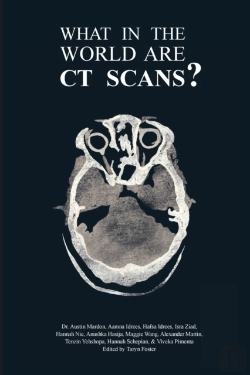 Bertrand.pt - What In The World Are Ct Scans?