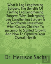 What Is Leg Lengthening Surgery, The Benefits Of Getting Leg Lengthening Surgery, Why Undergoing Leg Lengthening Surgery Is A Worthwhile Investment, What Causes Children To Succumb To Stunted Growth, 