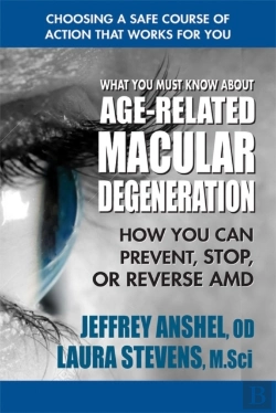 Bertrand.pt - What You Must Know About Age-Related Macular Degenration