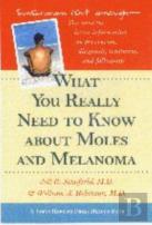 What You Really Need To Know About Moles And Melanoma