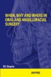 When, Why And Where In Oral And Maxillofacial Surgery
