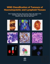 Who Classification Of Tumours Of Haematopoietic And Lymphoid Tissues