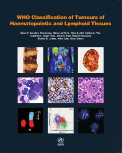Bertrand.pt - Who Classification Of Tumours Of Haematopoietic And Lymphoid Tissues