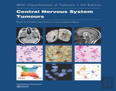 Who Classification Of Tumours Of The Central Nervous System