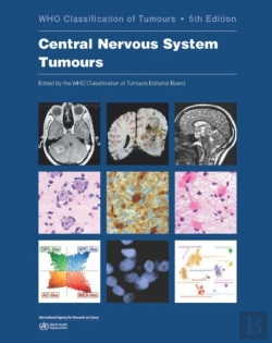 Bertrand.pt - Who Classification Of Tumours Of The Central Nervous System