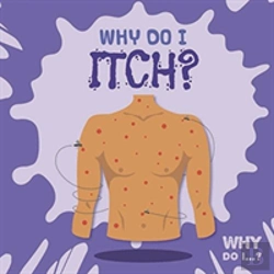 Bertrand.pt - Why Do I Itch?
