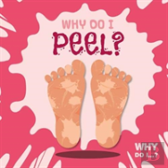 Why Do I Peel?