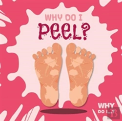 Bertrand.pt - Why Do I Peel?