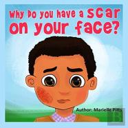 Why Do You Have A Scar On Your Face?