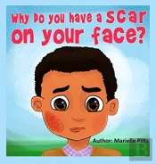 Why Do You Have A Scar On Your Face?