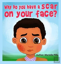 Bertrand.pt - Why Do You Have A Scar On Your Face?
