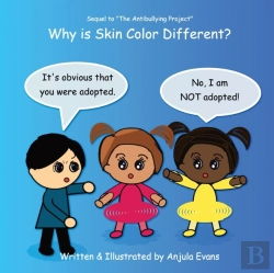 Bertrand.pt - Why Is Skin Color Different?