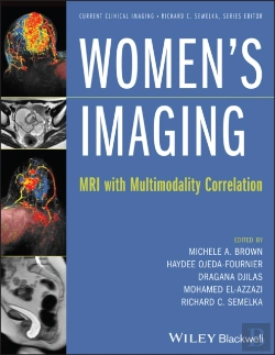 Bertrand.pt - Women'S Imaging