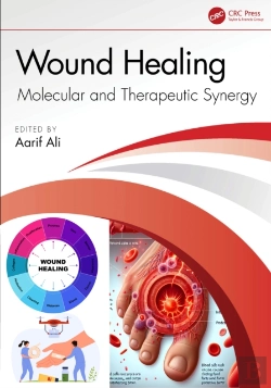 Bertrand.pt - Wound Healing